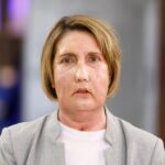 Realizan el primer trasplante facial del mundo con donante que recibió la eutanasia